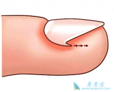 ʹ�ð���ҩ�����ּ׹�����ô�죿