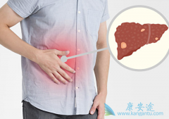 HBV��Ⱦ�ǵ��¸�ϸ��������Ҫ����֮һ