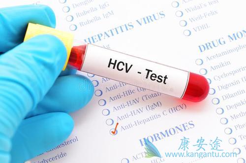 HCV